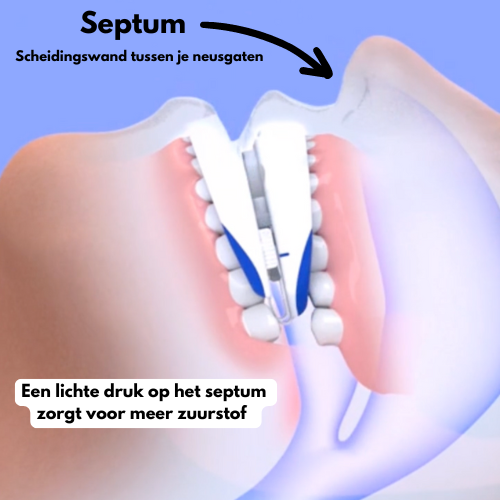Snurk Stopper™ - anti-snurk neusclip voor een rustige nacht